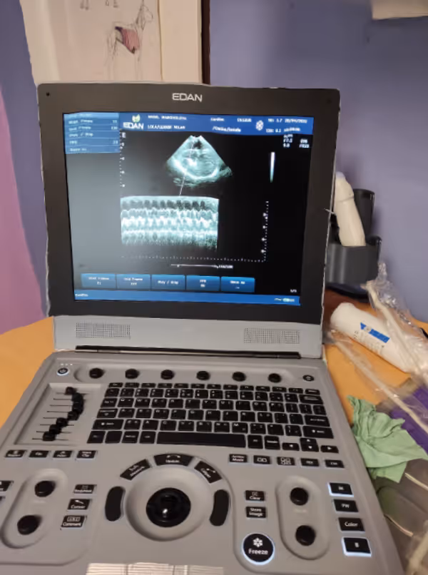 Sonografický přístroj